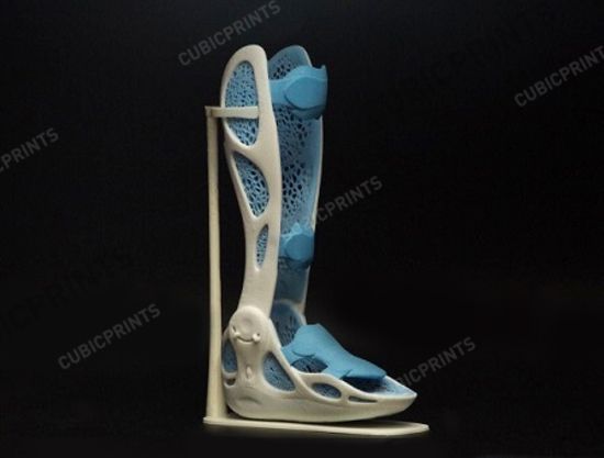 3d печать гипс – макет протеза